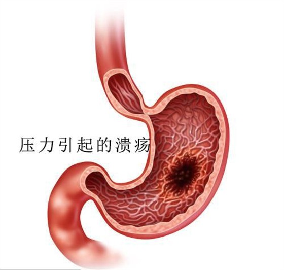 一个伟大的发现:抑郁症其实是一种代谢性疾病